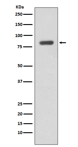 WB - Anti-IKK beta IKBKB Rabbit Monoclonal Antibody ABO13927